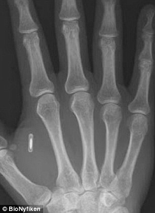 You can have a microchip implanted into your hands to pay for things